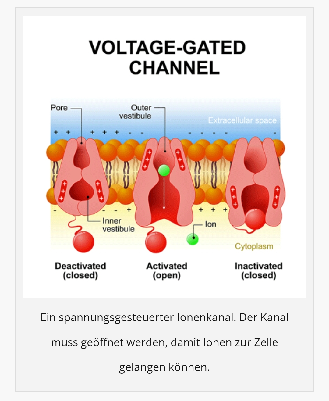 Healthrising Ionenkanalerkrankung