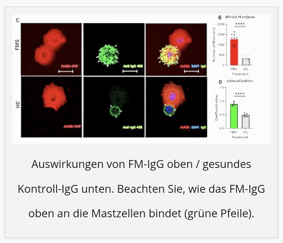 Healthrising Fibromyalgie Mastzellen